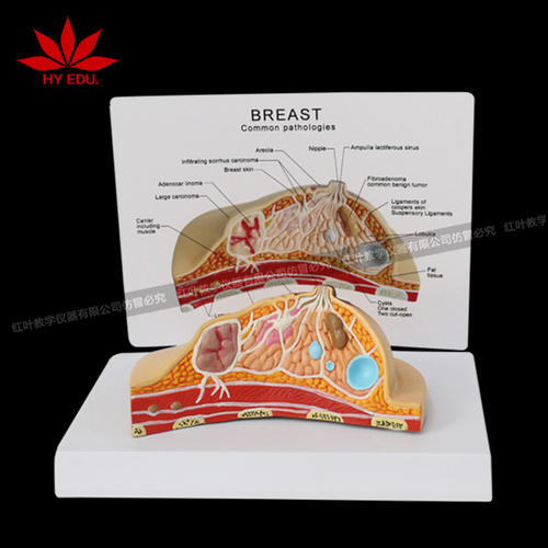 病理乳房医用模型